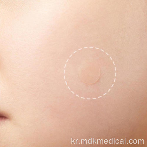 Hydrocolloid 보이지 않는 남성과 여성 여드름 패치